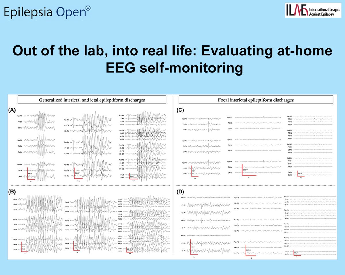 EpilepsiaOpen's tweet photo. Patients self-recorded 5-min resting EEG at home twice daily over a median 173.5 days using an 8-electrode dry cap.
https://t.co/SXN7EshMGE

#epilepsy #ILAE #epilepsiaopen #ambulatory #EEGmonitoring #inhome #remote #selfapplied https://t.co/z4zP7PoWGT