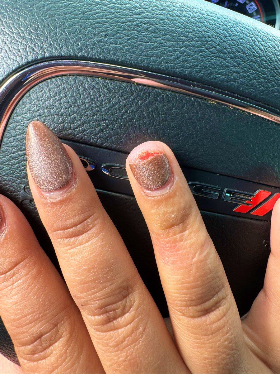 Ssenpaith1ccums's tweet image. Currently getting my nail fixed… hopefully this nightmare will be over soon.  😱🫣

#BROKEN