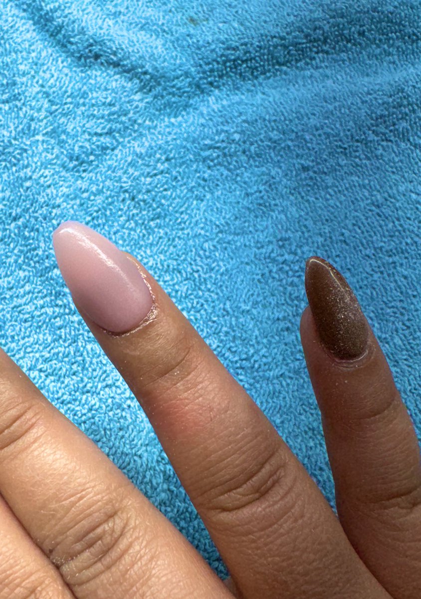 Ssenpaith1ccums's tweet image. Currently getting my nail fixed… hopefully this nightmare will be over soon.  😱🫣

#BROKEN