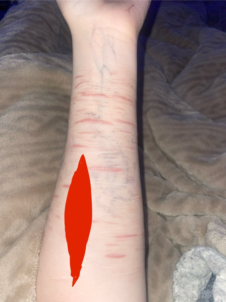 Yuricoochieeater of shtwt☽｡⋆ tweet media