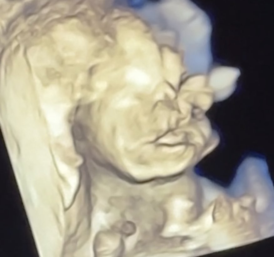 🙂‍↔️ tweet media