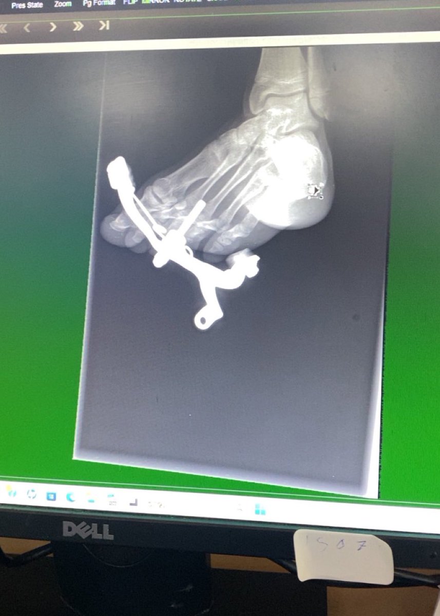 Just finished my ER rotation.Grateful for
every moment.

#برنامج_العمرة_المنهج