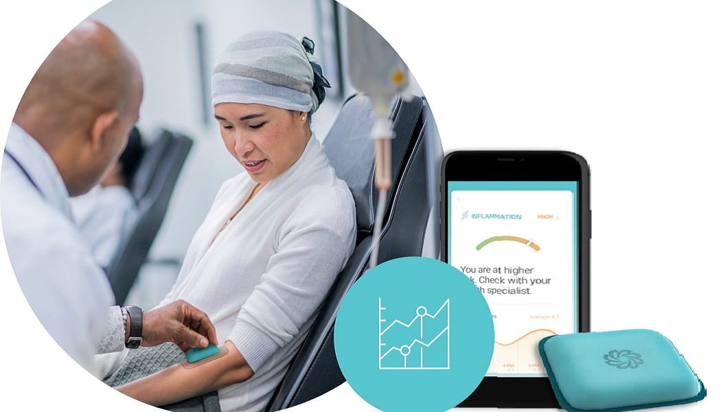 WilayahMy's tweet image. Xsensio Raises Oversubscribed $7 Million Series A to Accelerate Continuous Biosensing Innovation dlvr.it/TRJ8XS #Xsensio #SeriesA #Biosensing #HealthcareInnovation #VentureCapital