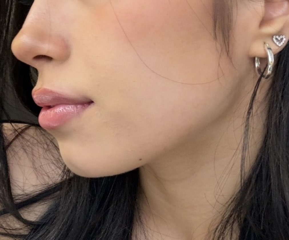 my experience in slimming down my face fat and bloating 

(a thread)