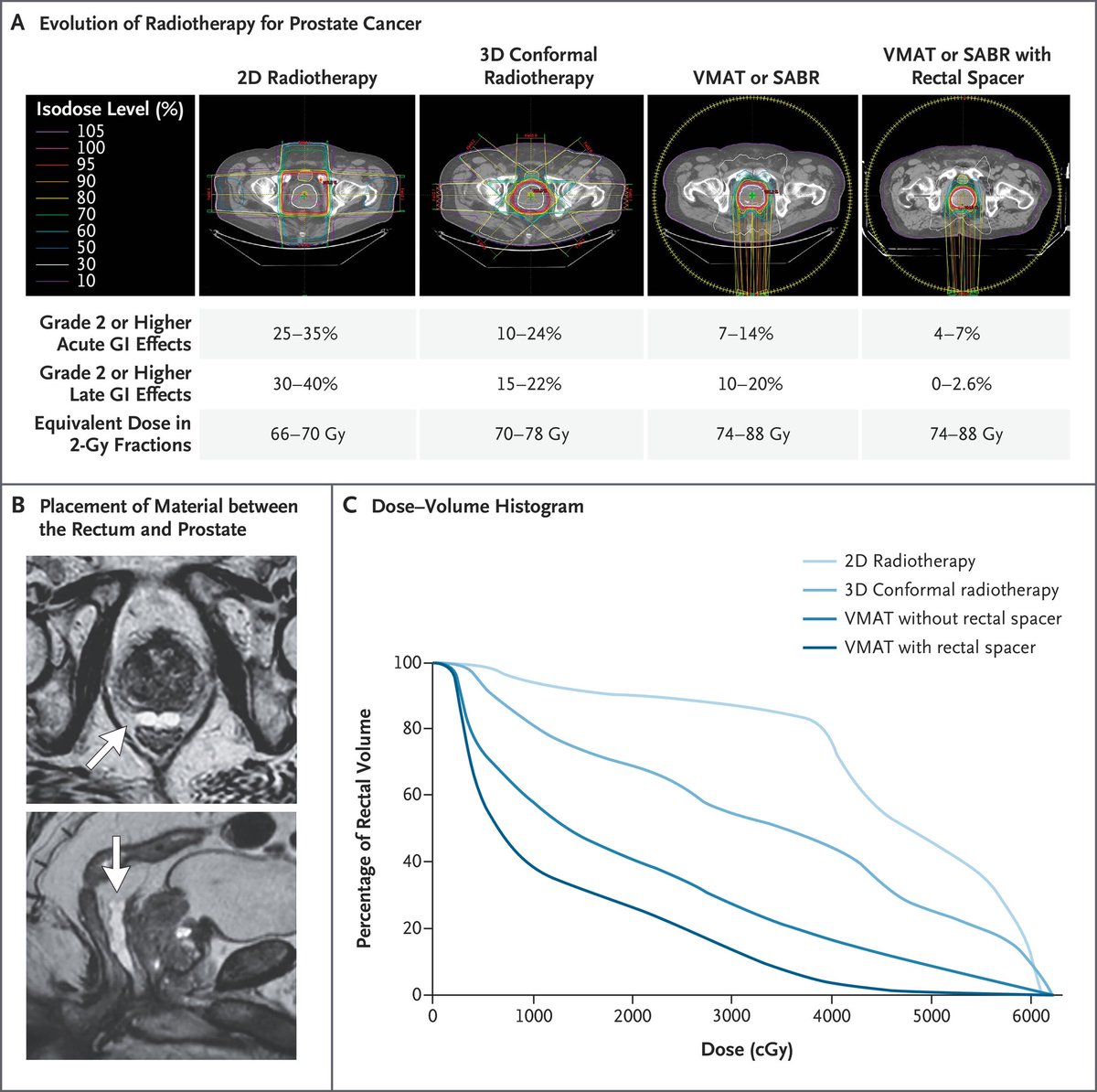 📌 Effects of Radiotherapy in Normal Tissue @OncoAlert #OncoAlertAF # ...