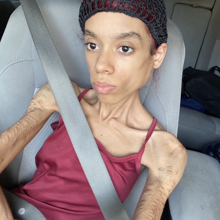 Fitness Wins tweet media