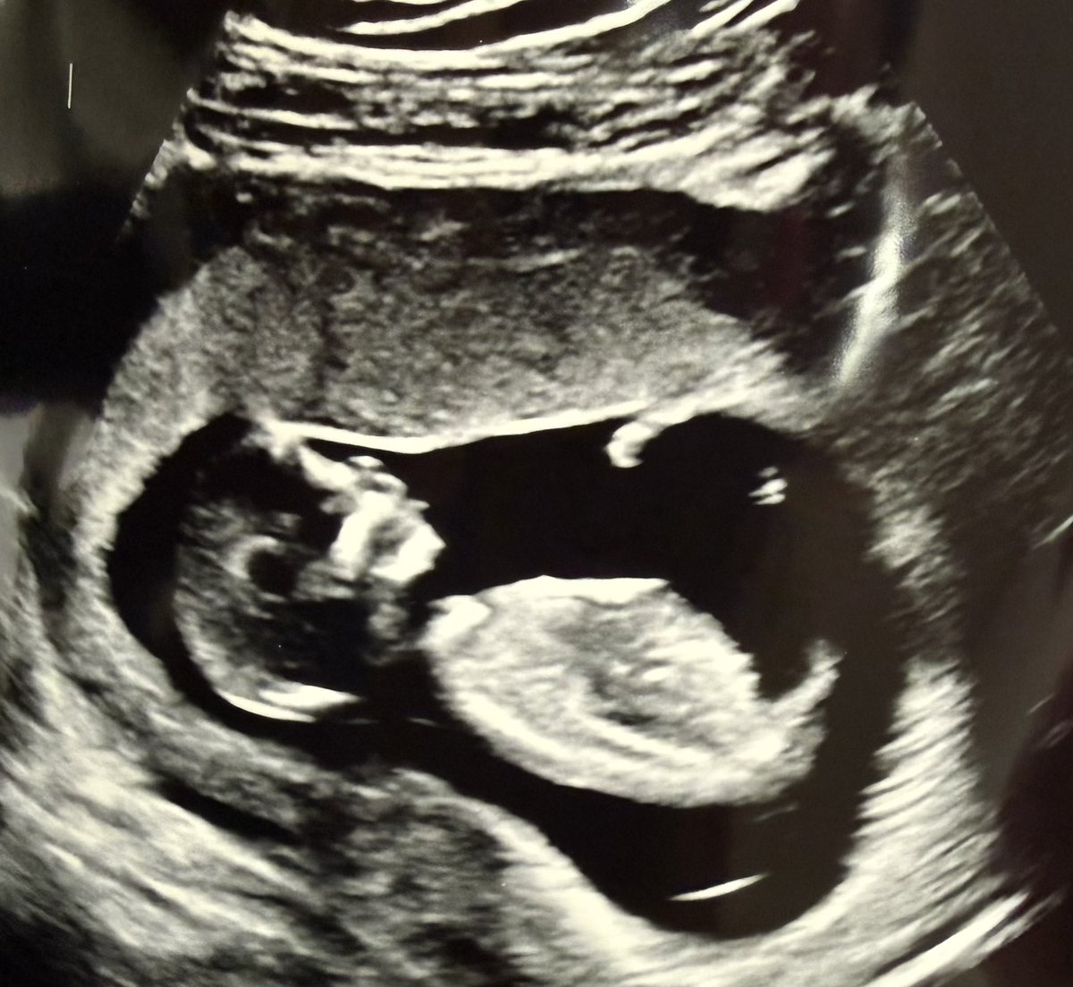 Happy Captain tweet media