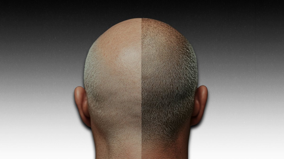 torontosmp's tweet photo. Toronto’s leading scalp micropigmentation and microblading studio, delivering precision results for men and women across the GTA — available in-studio and via private mobile appointments #TorontoSMP https://t.co/RGbyZ7TWPg