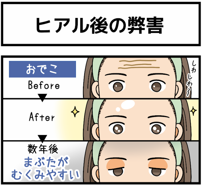 mabutanotarumi's tweet photo. ヒアルロン酸を入れた後、こんなはずじゃなかったとなるパターン👇 https://t.co/1FBGIY4PKf