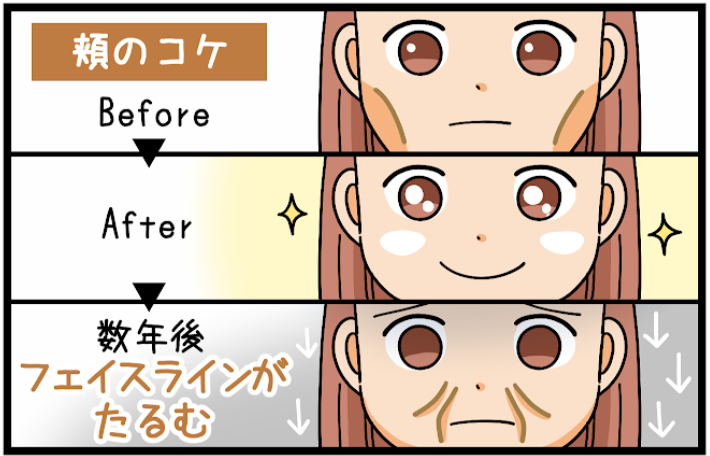 mabutanotarumi's tweet photo. ヒアルロン酸を入れた後、こんなはずじゃなかったとなるパターン👇 https://t.co/1FBGIY4PKf