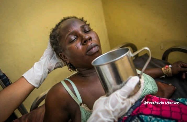This is the number one reason some women di£ within 24 hours after childbirth 😭

She gave birth safely.
She smiled.
She held her baby.

But within hours… she collapsed.
And just like that, a new mother was gone. 💔

👉 The leading k!ll£r of women after childbirth is something