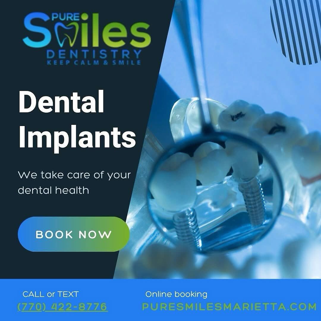 PureSmiles1's tweet image. The premium option for replacing missing teeth is dental implants. No other tooth restoration looks or feels as natural, with a permanent new tooth surgically placed to complete your smile.#PureSmilesDentistry #dentalimplants #oralcare #implantdentistry #smilemakeover