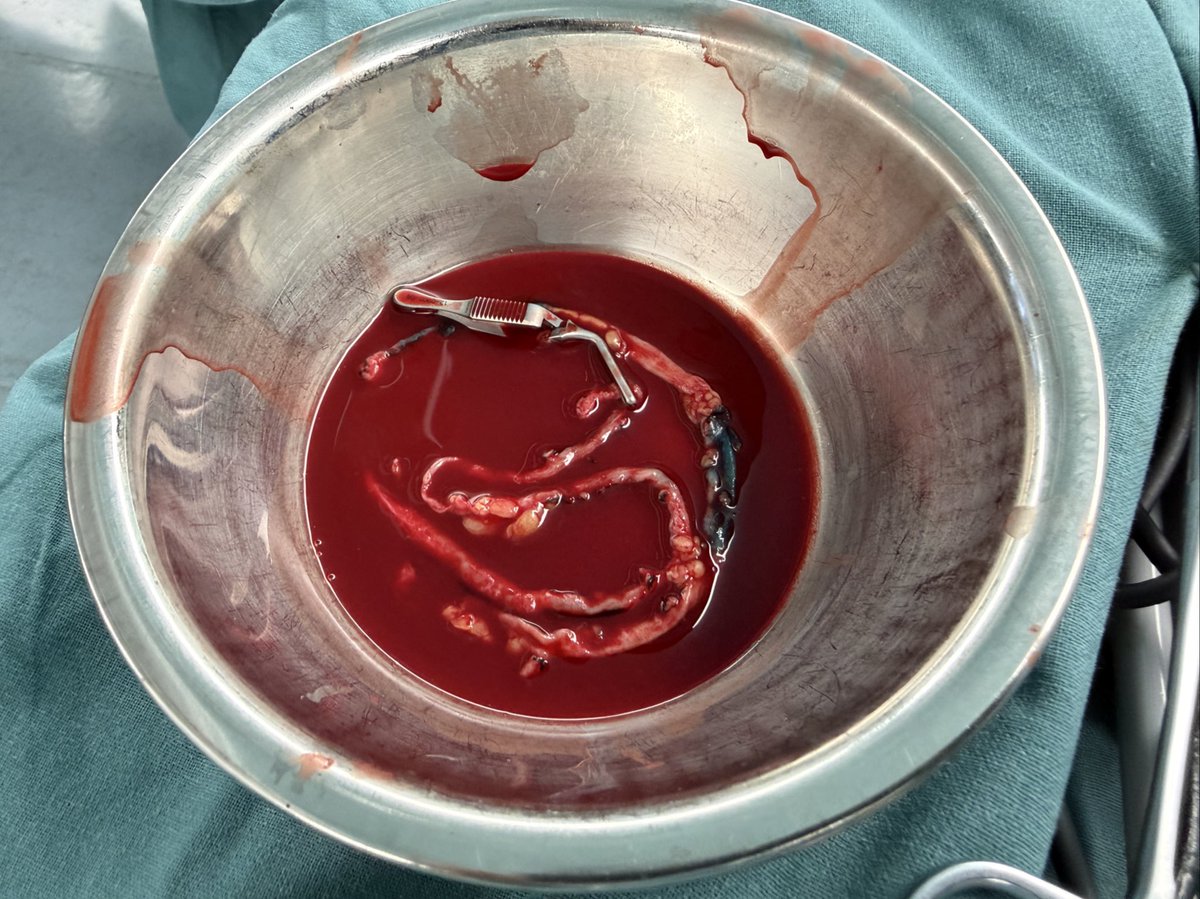 Jianing Yue_Vas Surg in Shanghai tweet media