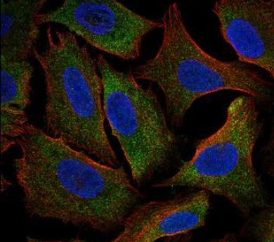 Human Protein Atlas tweet media