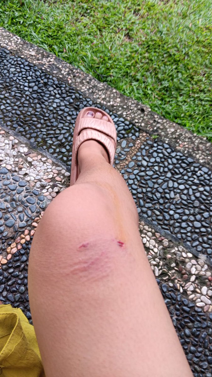 umusaaal_'s tweet photo. Jahat bgt monyet udah dikasih makan minum tmpt tinggal tbtb lepas tp aku yg diserang, pdhl bnyk org. Jahat km nyet, gakan lg aku kasi km apa2, liatpun mls https://t.co/SBZQQCUZPY