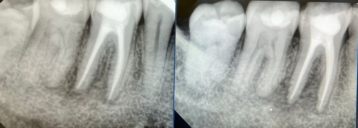 𝓈𝓱𝑜𝑟𝑜𝓊𝑞 ᥫ᭡ tweet media