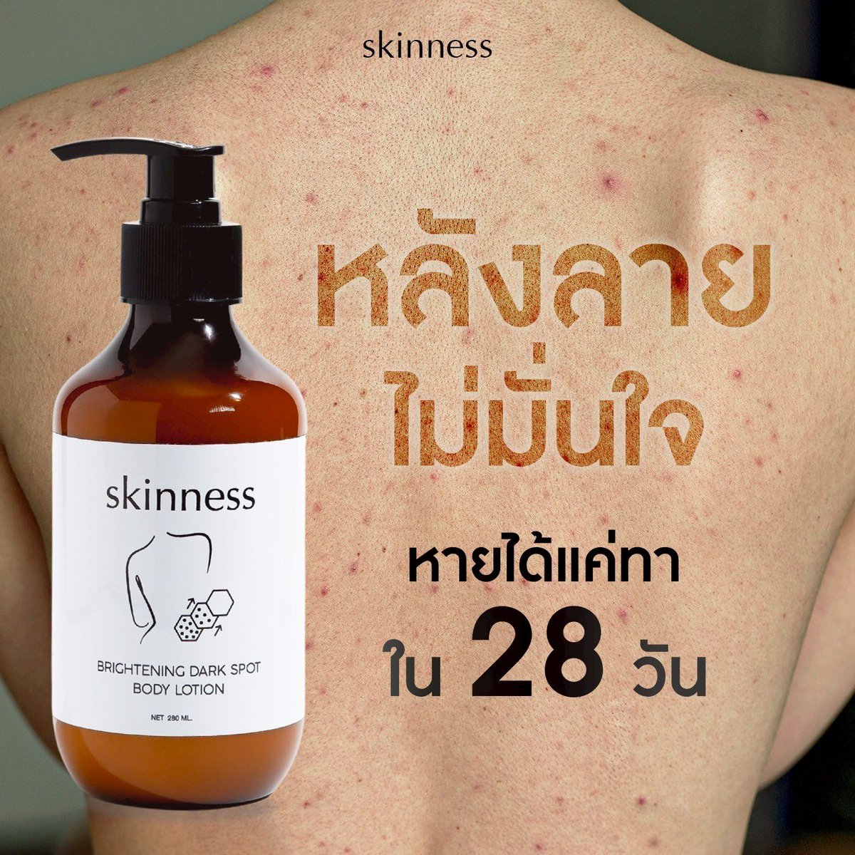 skinness official tweet media