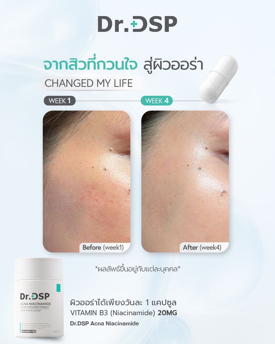 Dsp_Supplement's tweet photo. ผิวดูออร่า เรียบเนียนขึ้นได้ใน 4 สัปดาห์* 
ดูแลผิวจากภายในด้วย Dr.DSP Acna Niacinamide

วิธีรับประทานวันละ 1 แคปซูล
*ผลลัพธ์ขึ้นอยู่กับแต่ละบุคคล

യ Shop online:
✦ Shopee: https://t.co/Gz1YyHuJ26
✦ Lazada: https://t.co/hP0kHenKmV

#DrDSP #AcnaNiacinamide #อาหารเสริมผิวใส https://t.co/UNfWpZuFoi