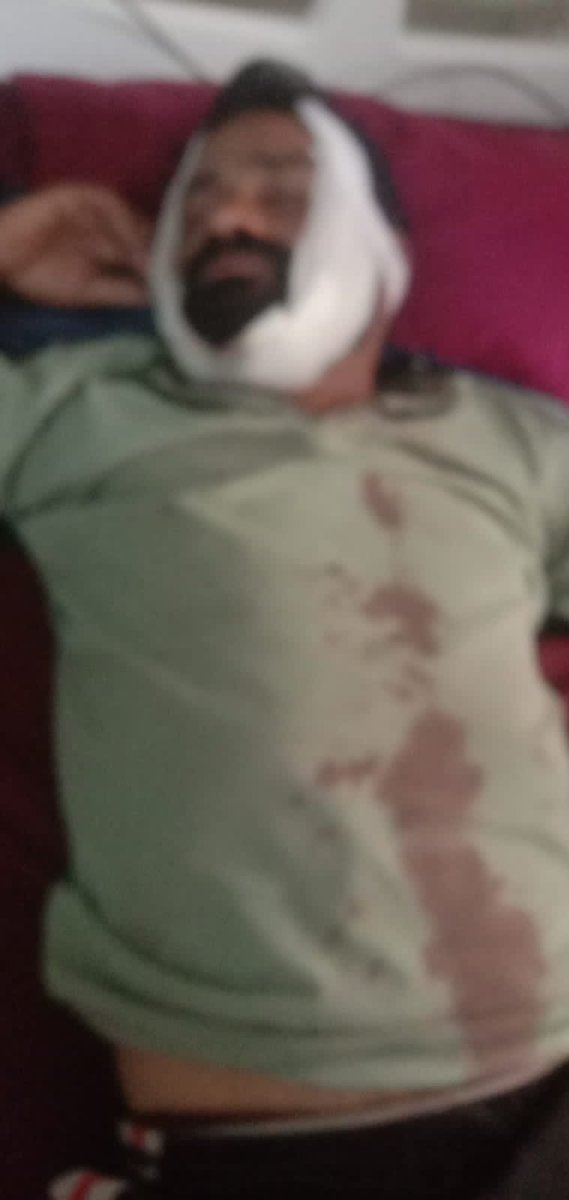 DeepKumarrao3's tweet photo. थाना मेजा के जवनिया गांव में एक गरीब व्यक्ति को लाठी डंडों से मार पीट के सर फोड़ दिया गया जिसकी हालत गंभीर है परंतु अभी तक मुकदमा दर्ज नहीं किया गया। चौकी इंचार्ज जवनिया  पीड़ित परिवार पर दबाव और डराया धमकाया जा रहा समझौते के लिए ।उच्च अधिकारी संज्ञान ले @DCPYNagarPrj
@Uppolice https://t.co/QvgyEh3TH9