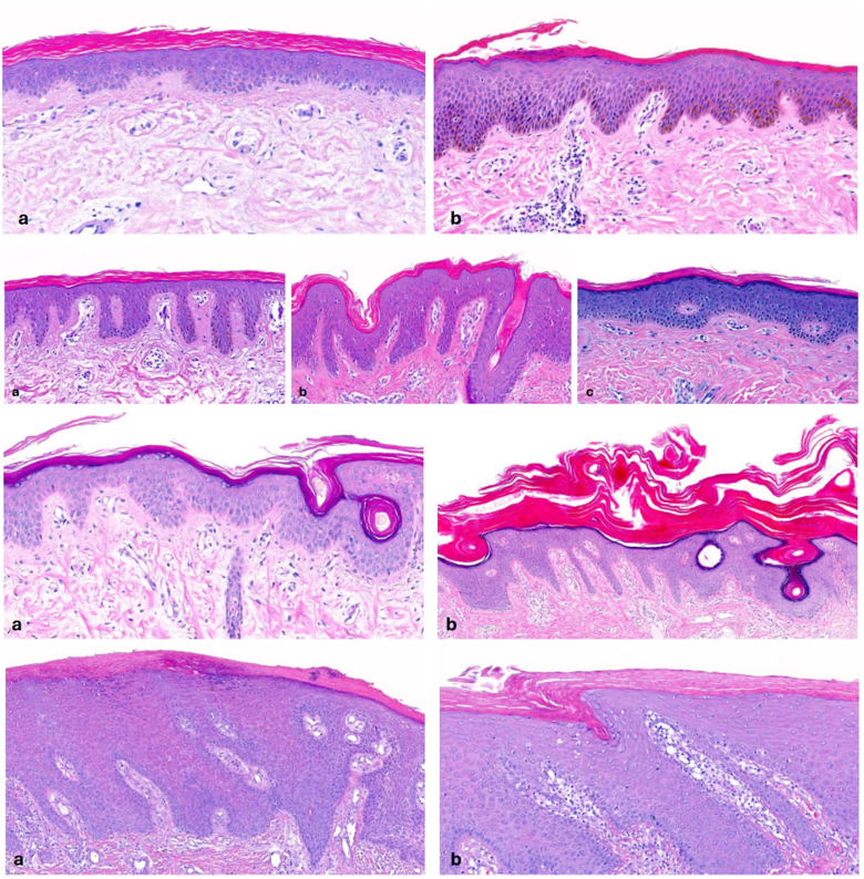 Dermatopathology tweet media