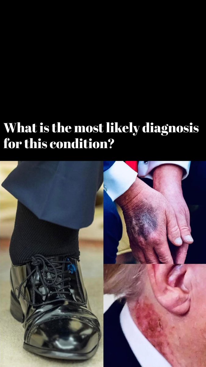 ImNdral7's tweet photo. Spot diagnose??
🤔🤔🤔
@realDonaldTrump 
#MedTwitter https://t.co/B5CVInbJNz