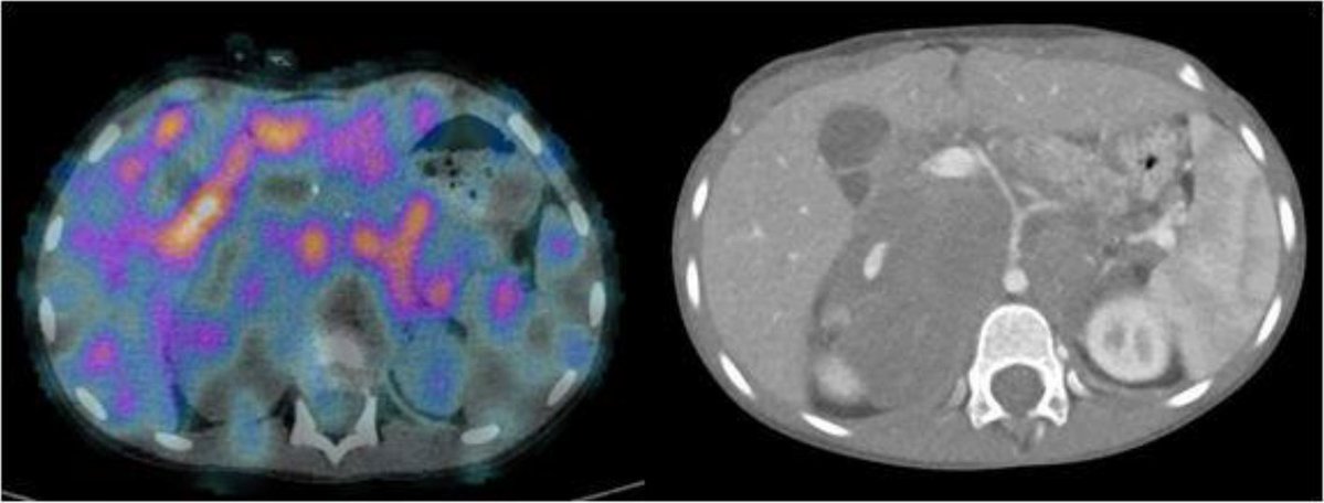 CVIR Oncology tweet media