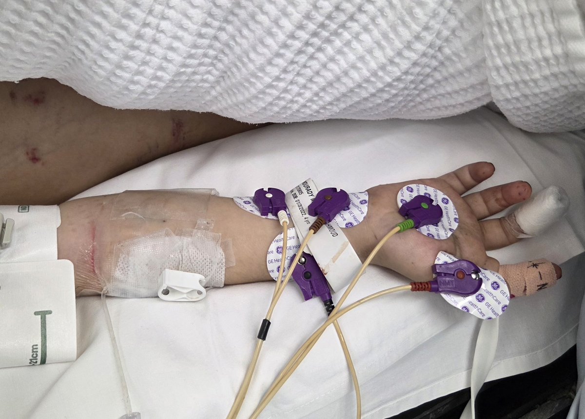 4 year old with facial injuries. Mother killed, father's body still under the rubble, surviving sibling with head injury.
Israel must be stopped.