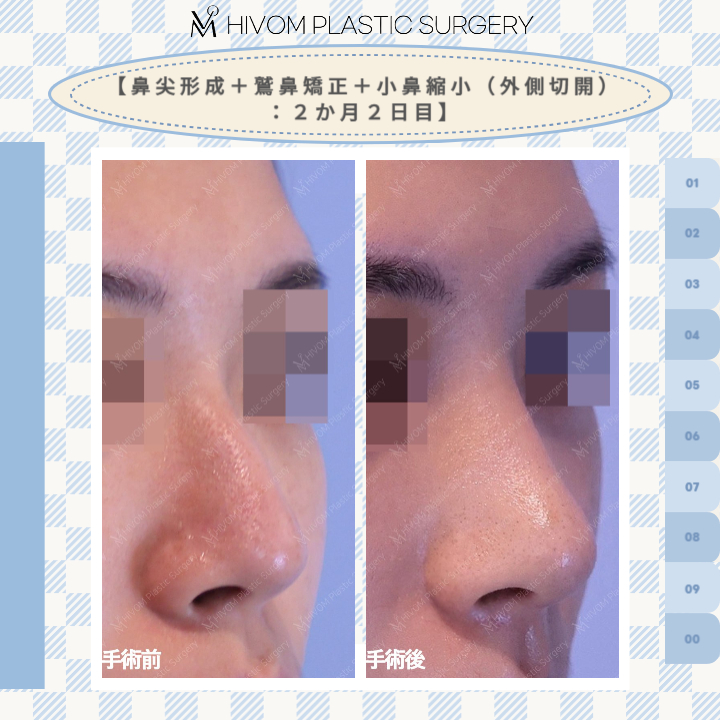 ハイボム美容外科🍑プチ整形🍑 tweet media