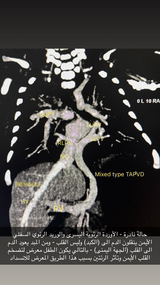 Bin-Moallim | محمد بن معلّم 🩺 tweet media