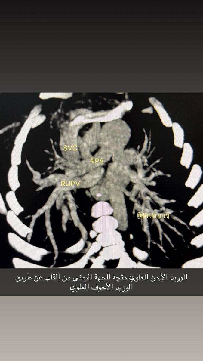 Bin-Moallim | محمد بن معلّم 🩺 tweet media