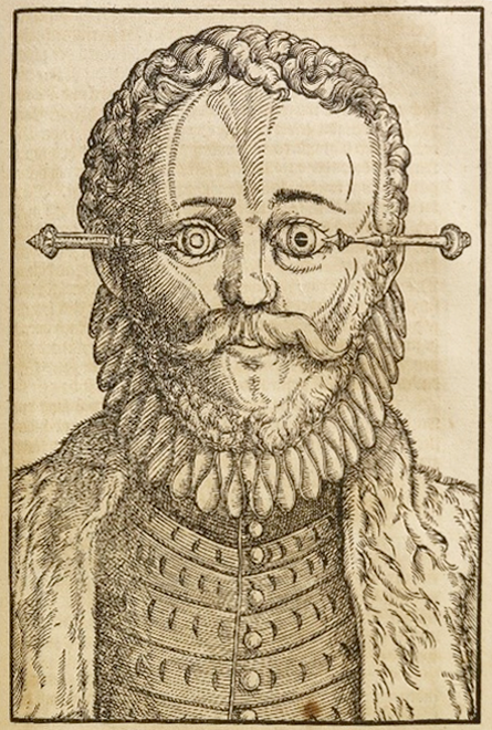 EyeNewsMag's tweet photo. Imagine it’s 1583. Your vision is failing. The cure? A surgeon is going to take a silver needle and push the cloudiness inside your eye downwards. 👁️
No anaesthetic. No antibiotics. Just "couching". It didn't cure the cataract, but it let the light back in.
#eyenews #EyeHistory https://t.co/J0j03NjOio