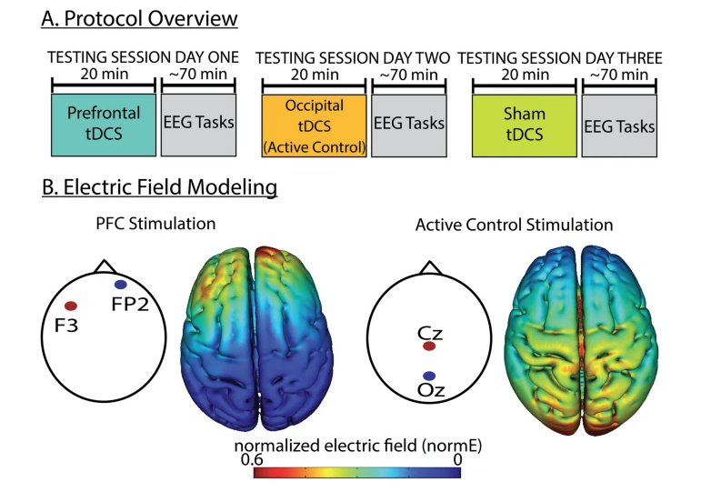 Neuroelectrics tweet media