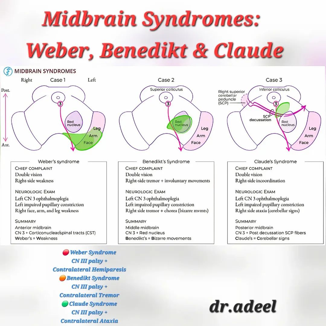 Neurosurgery Cocktail tweet media