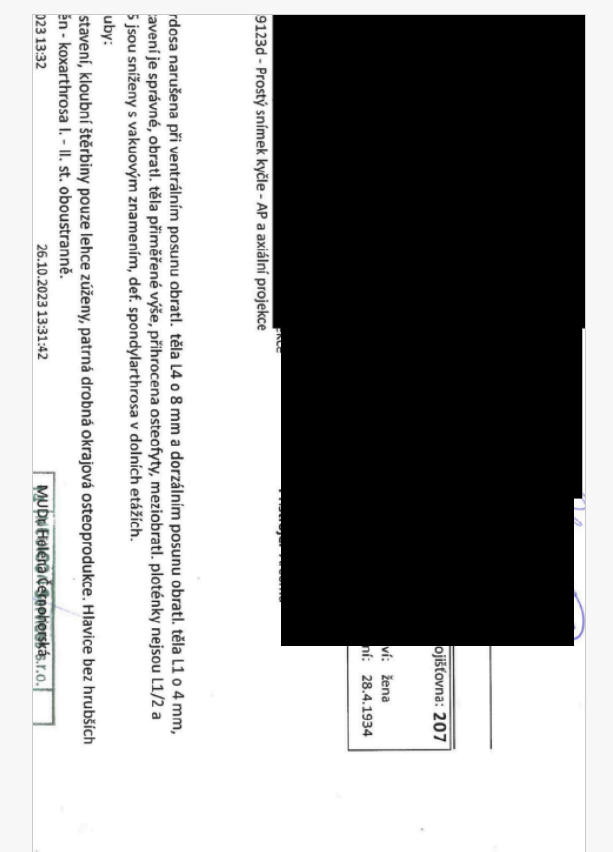 Postulka's tweet photo. 1/ Pacient 92 let. Polymorbidní. Přinese do ordinace dokumentaci jako fotokopie a JPEGy z mobilu. Různě otočené, místy špatně čitelné.  Bez AI: 15–20 minut orientace v papírech. S AI: 30 sekund.   Pokračování zde https://t.co/3pbv4HOT66 https://t.co/mgFIjGL1k1