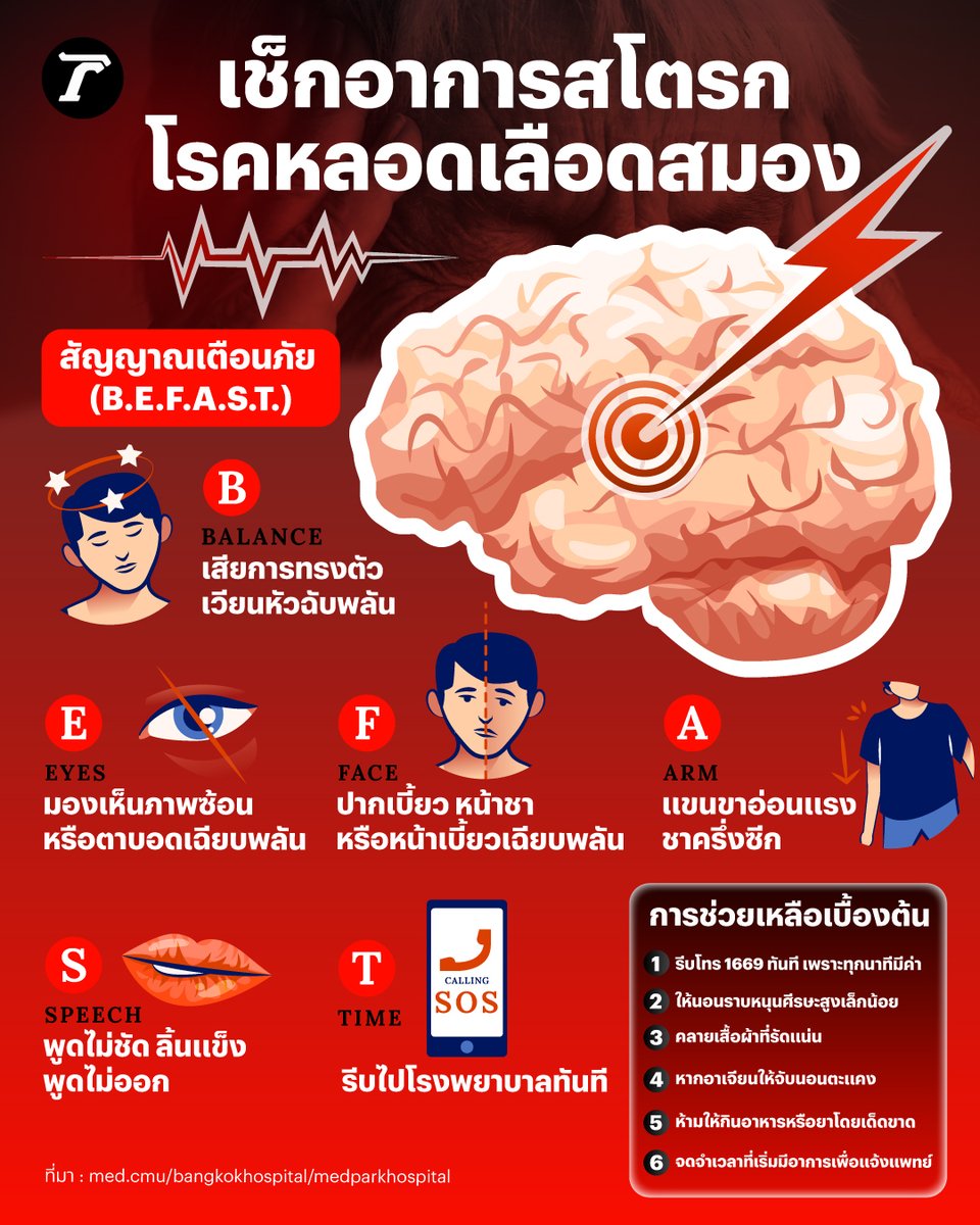 เช็กอาการสโตรก สัญญาณเตือนภัย โรคหลอดเลือดสมอง

📌สโตรก (Stroke) หรือโรคหลอดเลือดสมอง

คือ ภาวะที่สมองขาดเลือดไปเลี้ยงจากการตีบ อุดตัน หรือแตก ทำให้เซลล์สมองถูกทำลายอย่างรวดเร็ว ส่งผลให้เกิดอาการอัมพฤกษ์ อัมพาต หรือเสียชีวิตได้

🚨สัญญาณเตือนภัย (B.E.F.A.S.T.)

B - Balance: