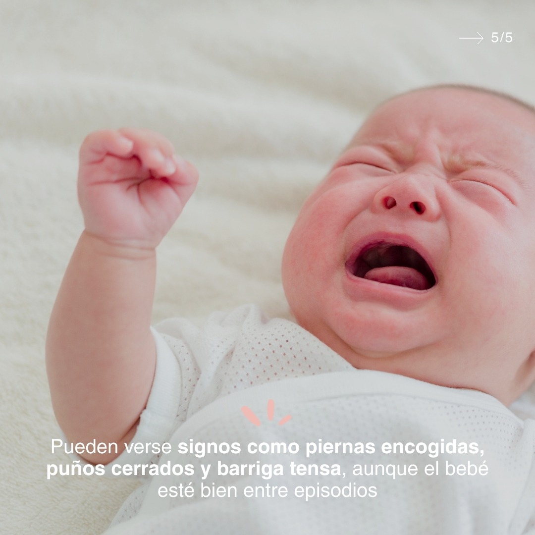 creciendosanos_'s tweet photo. En los primeros meses, es habitual ver episodios de llanto, esfuerzo y malestar. Pero no todas las molestias digestivas significan lo mismo.

Te explicamos cómo identificar la disquecia y el cólico del lactante, qué suele ocurrir en cada caso y por qué pueden confundirse.