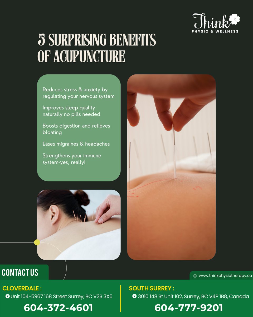 physiothink's tweet photo. Discover The Surprising Benefits Of Acupuncture. It May Help Reduce Stress And Anxiety, Improve Sleep Quality, Support Digestion, Relieve Migraines, And Strengthen Your Immune System.

Registered Massage Therapists Surrey | Physiotherapy Surrey | Top Rated Physiotherapy in Surrey https://t.co/vIJPCrYkO8