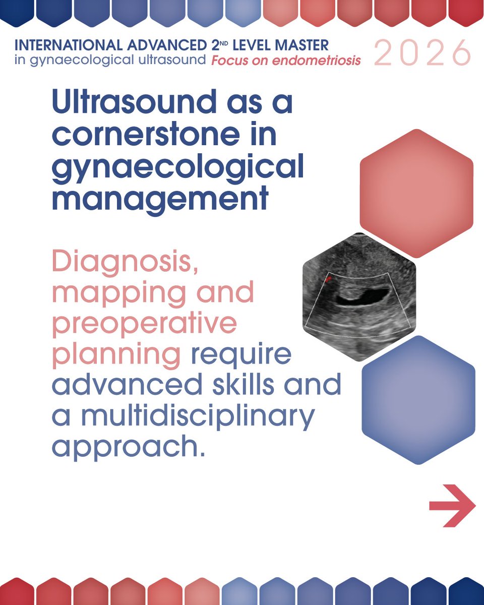 SymposiaOC's tweet photo. International Advanced 2nd Level Master
Gynaecological Ultrasound – Focus on Endometriosis
3 Online Courses with 6-month access to full recordings + 5-Day Clinical Observership
From theory to the operating room.

April–May-September 2026 | Italy
https://t.co/MaptuqE2QM https://t.co/7ftMFdG0ed
