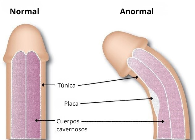MindBodyIsLife's tweet photo. 8 vitaminas que los hombres con erecci0nes débiles deben tomar con frecuencia.

-Revisar hilo- 👇🏼 https://t.co/wpkdRtxQY7