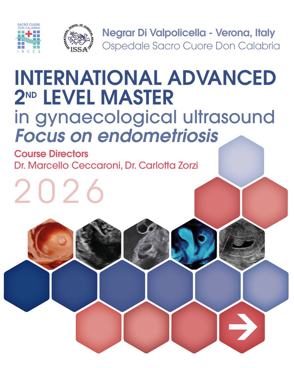 SymposiaOC's tweet photo. International Advanced 2nd Level Master
Gynaecological Ultrasound – Focus on Endometriosis
3 Online Courses with 6-month access to full recordings + 5-Day Clinical Observership
From theory to the operating room.

April–May-September 2026 | Italy
https://t.co/MaptuqE2QM https://t.co/7ftMFdG0ed