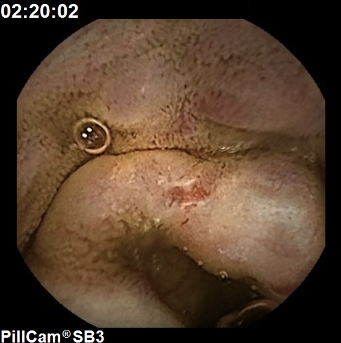 Ignacio Fernández-Urién tweet media