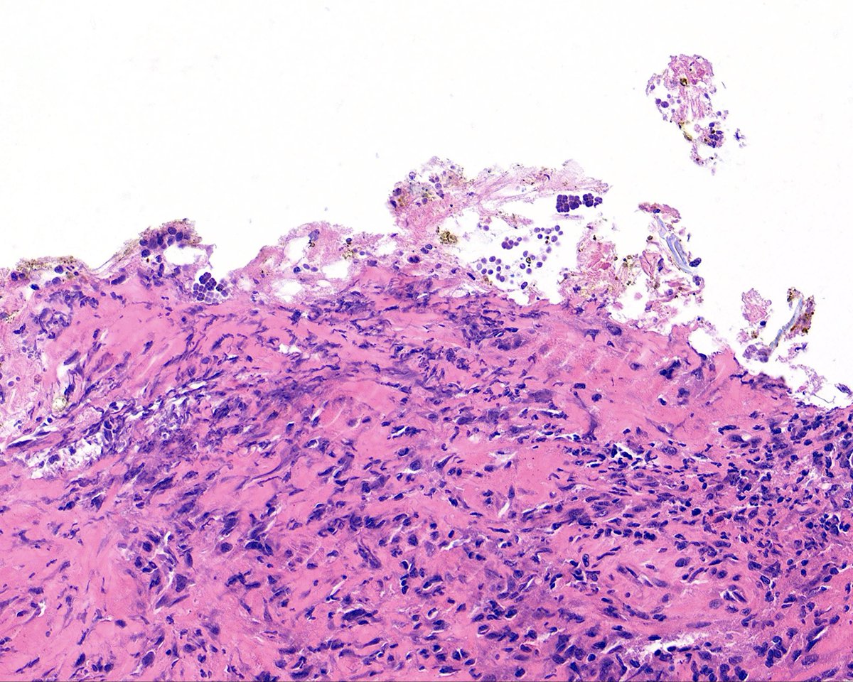 Surgical Pathology Cases tweet media