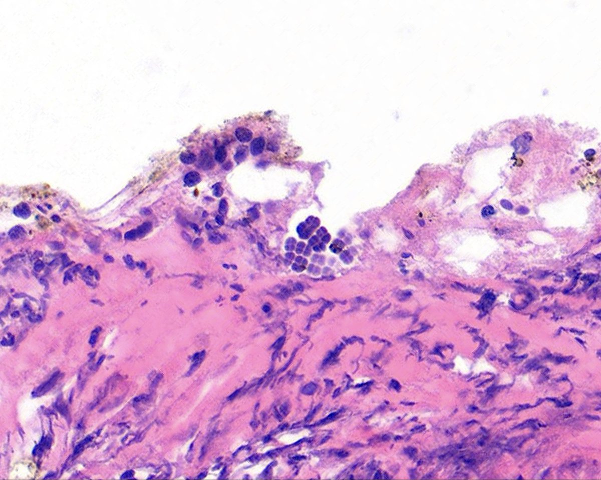 Surgical Pathology Cases tweet media