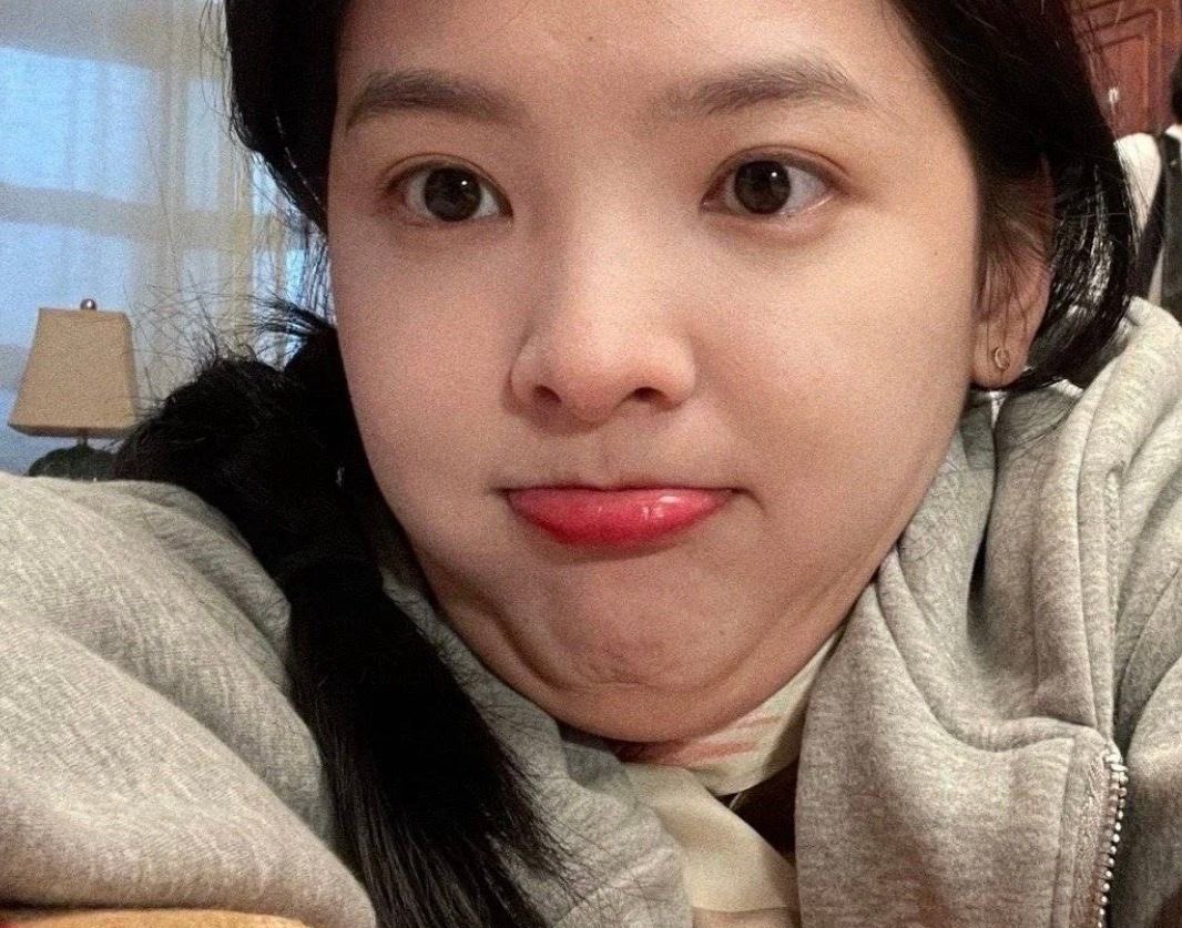 망구 tweet media