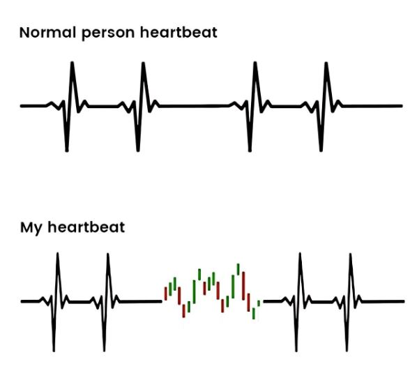 moonx_bydfi's tweet image. If you don't trade, you don't even know what a heartbeat feels like.💛
#Degens #Solana #Memecoins