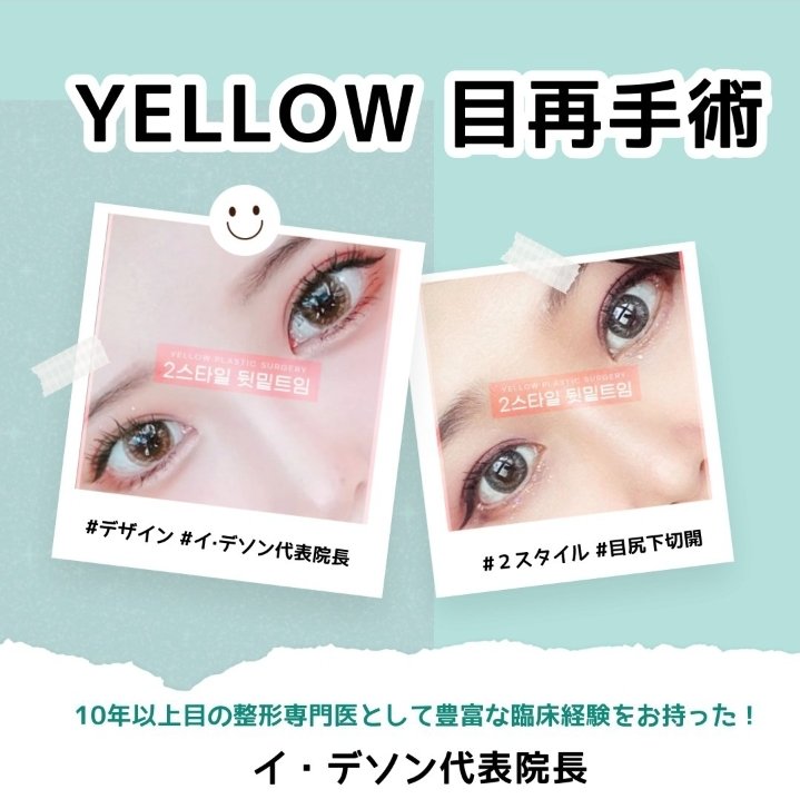 ■韓国整形■イエロー美容整形外科日本人公式エージェンシー tweet media