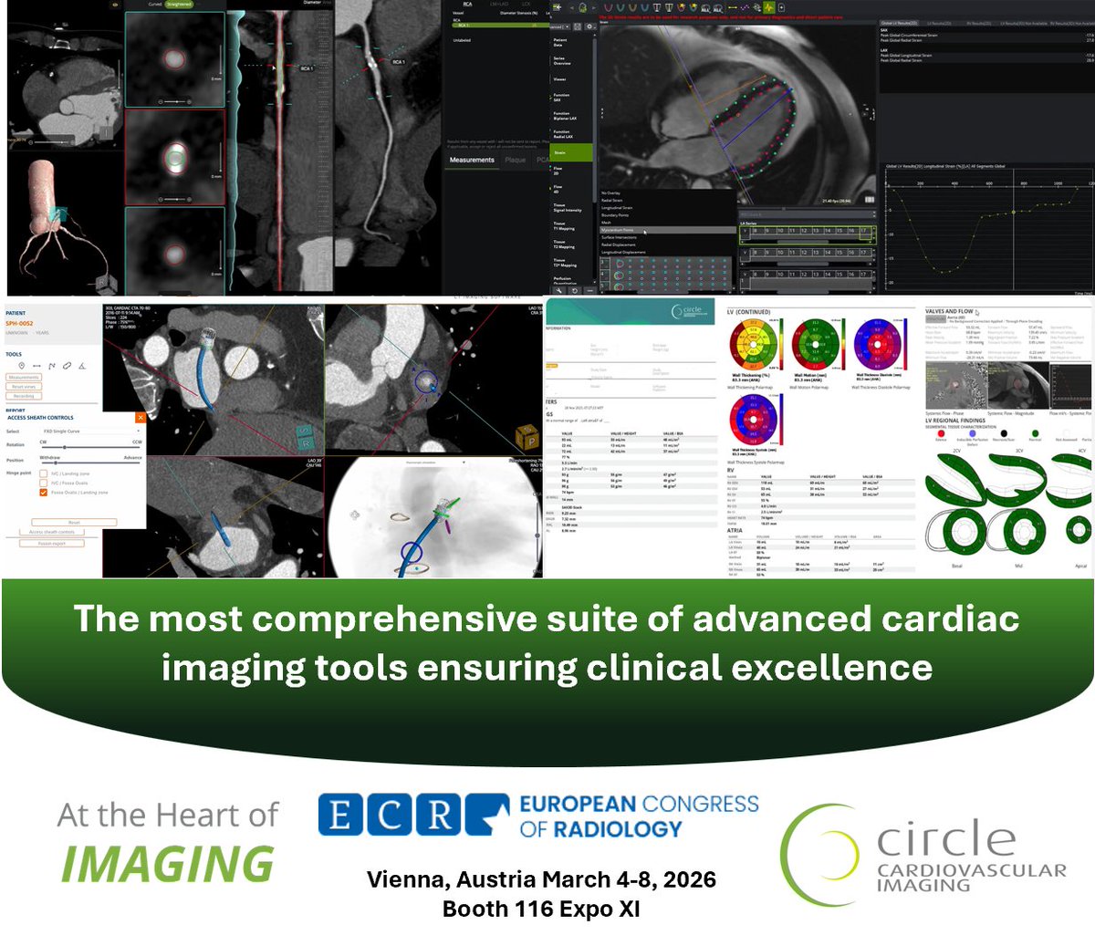 Circle Cardiovascular Imaging tweet media