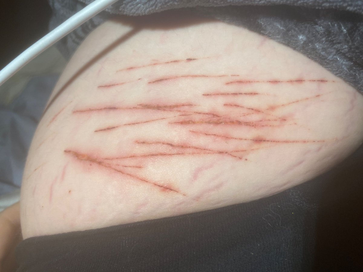 Fluttershy of shedtwt tweet media