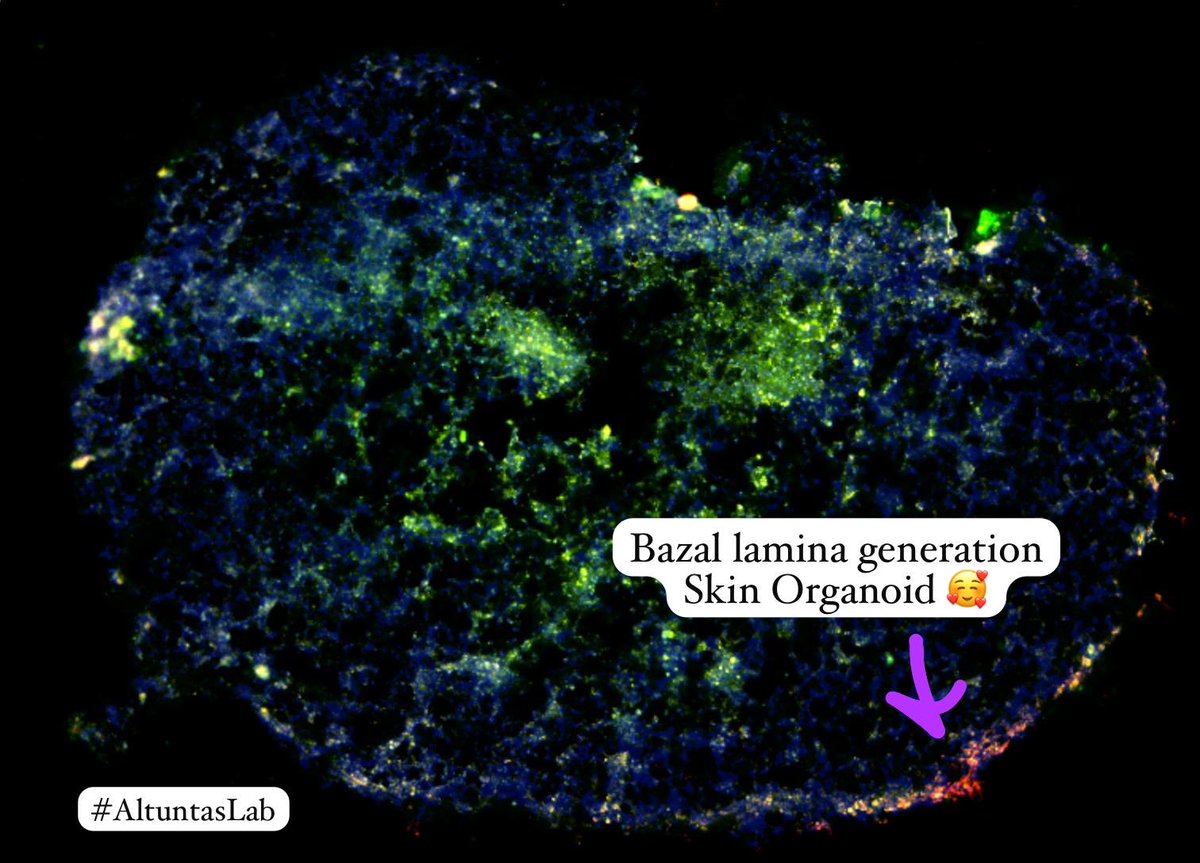 SevdeAltuntas's tweet photo. Bugün güzel bir gün.. Kök hücre kökenli deri organoidlerimizde bazal lamina oluşumu 🥰 #AltuntasLab https://t.co/UoWMUolMRH