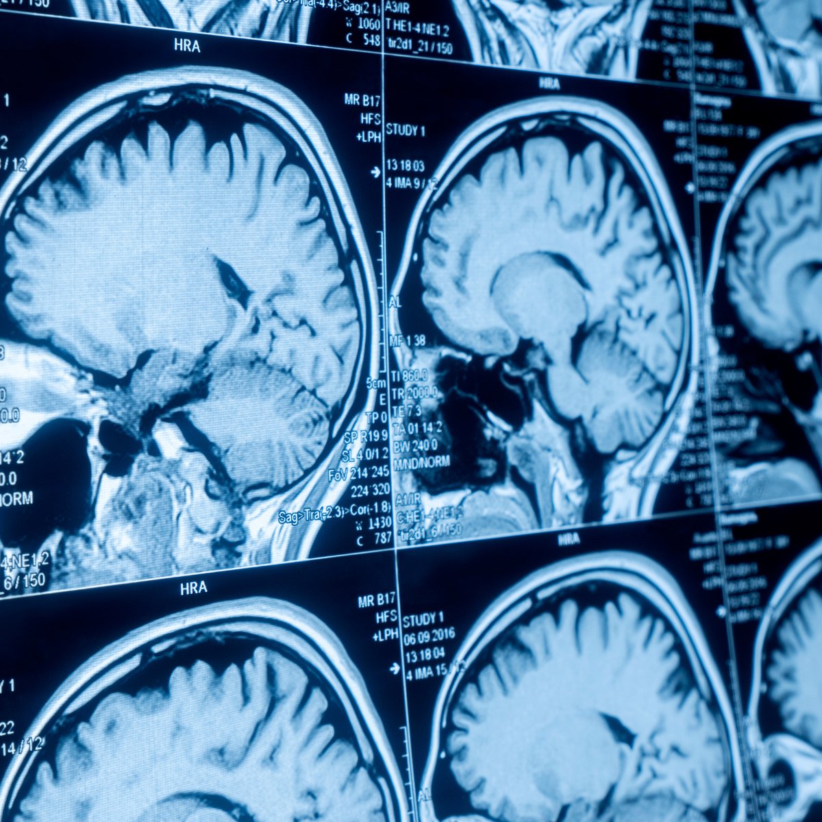 umed_wroc tweet media